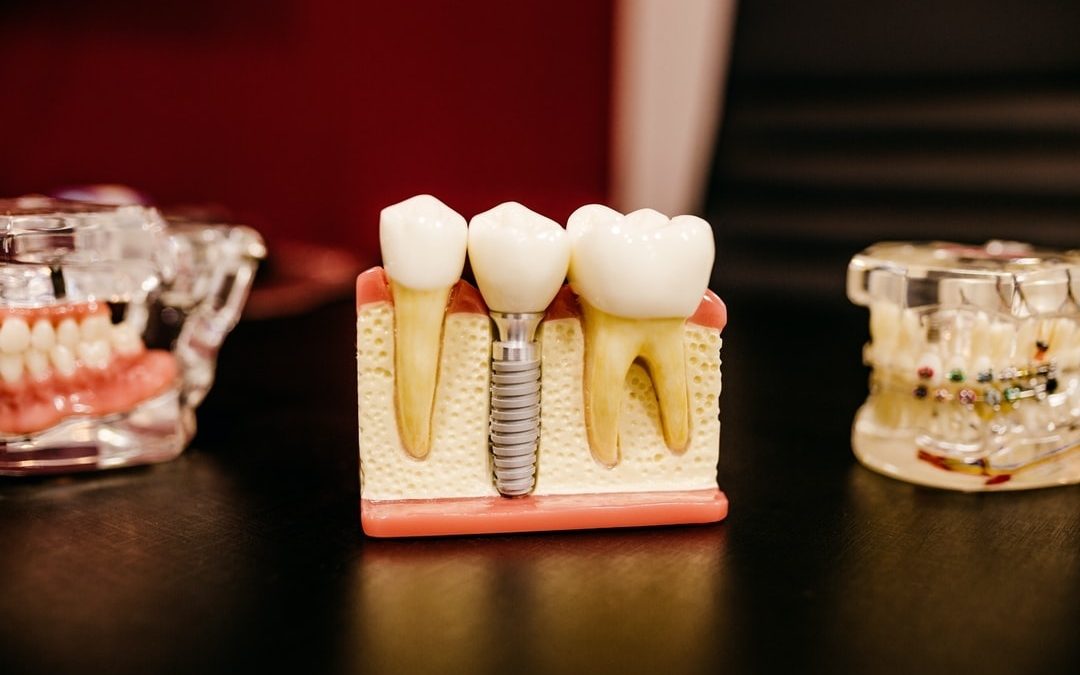 Teeth Structure